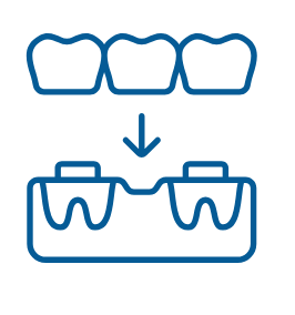 Crown & Bridge Treatment