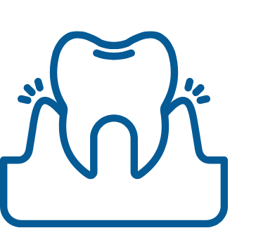 Gum Treatment (Periodontics)